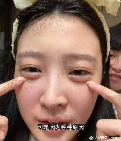 深圳艺星医疗美容医院丰卧蚕大概需要多少钱受哪些因素影响？
