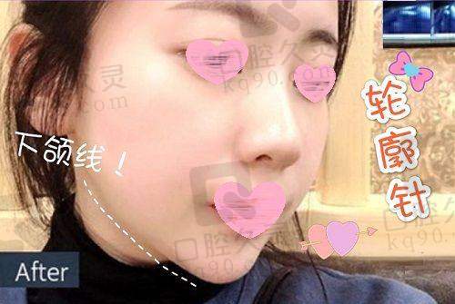 西安晶肤医美价格合理吗？