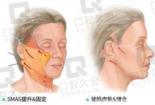 三、张家港英格丽尔医疗美容门诊部诊疗项目有哪些？