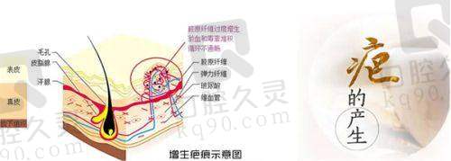 西安晶肤医美的医生团队专精吗？