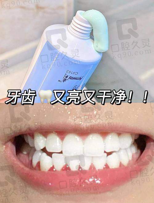 牙齿美白后的成效如何?