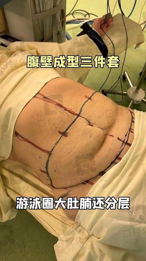 用户反馈热度高，肚子紧了，心里才真的“美了”