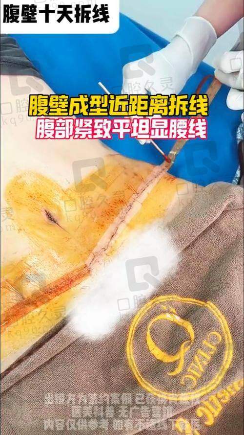 李献和与张航医生对比 —— 技术风格不同，各有千秋