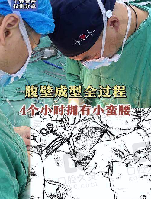 李献和腹壁整形真实实例反馈，术效稳定有说服力