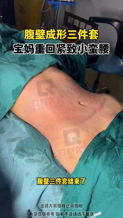 李献和腹壁成形的疤痕处理技术口碑炸裂，“细到像绣花”