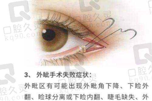 重庆华美整形医院哪个医生做眼睛好?知名专家揭秘眼部整形优质之选