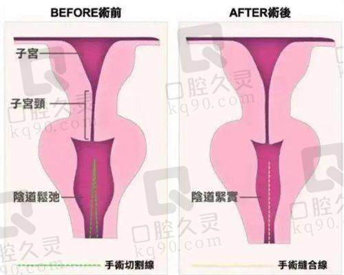 合肥维多利亚整形医院与其他整形医院相比有哪些优势?
