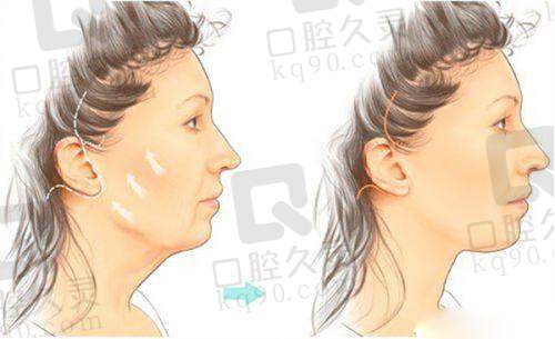 乌鲁木齐华美整形医院是正规医院吗?权威认证、专业医师、优质服务给出肯定答复