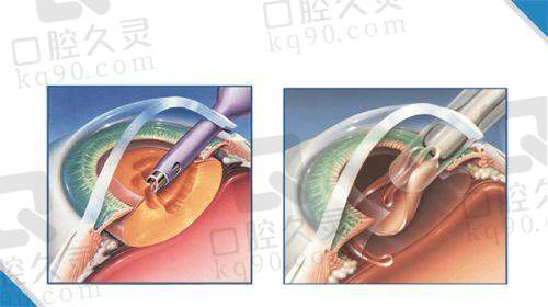 揭阳市人民医院