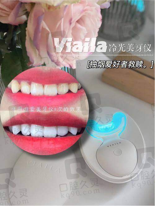牙齿贴面美白方案是如何制定的?