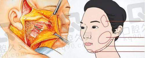 倪锋医生在哪家医院坐诊？上海伯思立预约挂号、坐诊时间等实用信息大公开