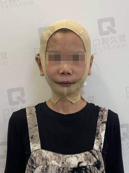 术后能享受什么附加服务?可接受多次吗?