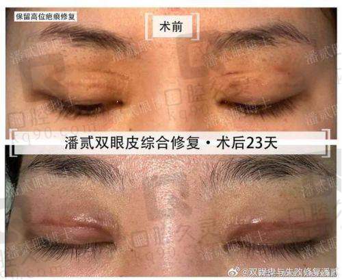 术后修复怎么样?黄军伟医生设有专属护理方案