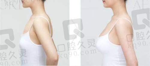 五、吴毅平收费价格表