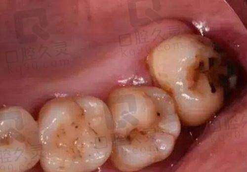 不同口腔需求如何选择医生?建议看这几点