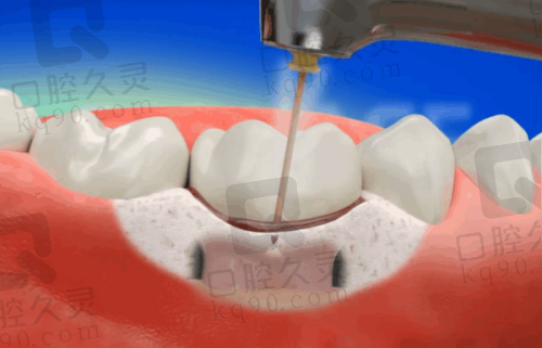 青州潍医口腔诊疗项目多