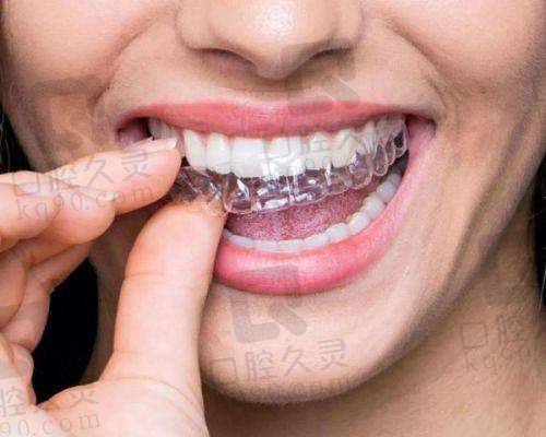 马鞍山市人民医院牙齿矫正价格如何?