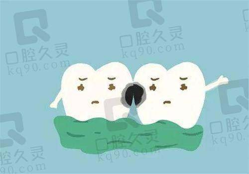 青州潍医口腔医生强