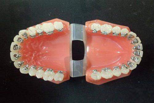 浙医一院口腔科就诊准备