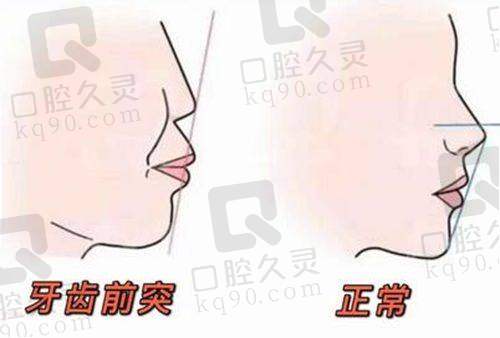 潍坊寿光华贝口腔医院德系种植牙的品质优势