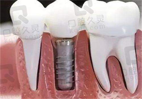 马鞍山市人民医院牙科的问诊流程值得说说!