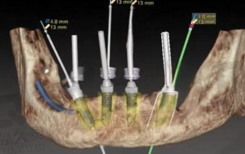 马鞍山市人民医院牙科价格表