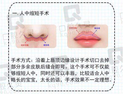 谭拯项目价格表参考