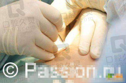 六、吴毅平怎么预约?