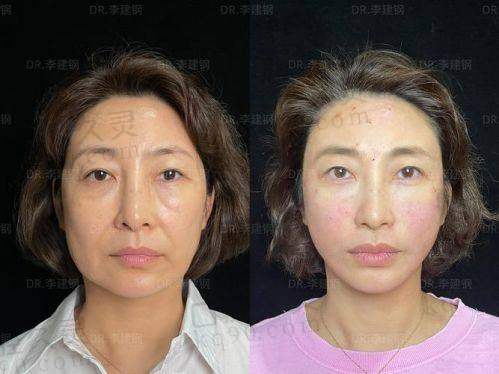 北京八大处张超医生简介