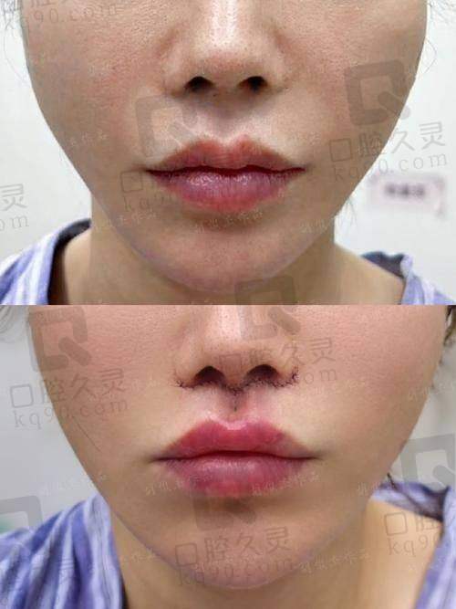 谭拯个人资料及简历