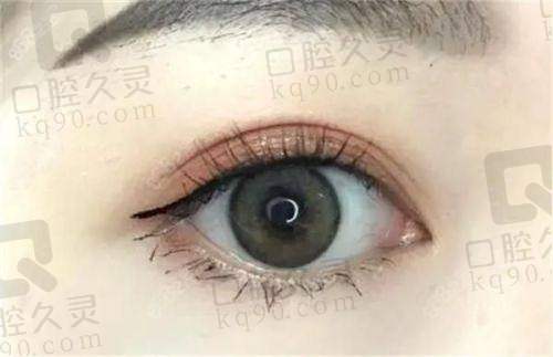 掌握上海管果双眼皮修复避雷要点，轻松拥有自然美眼不花一分冤枉钱！