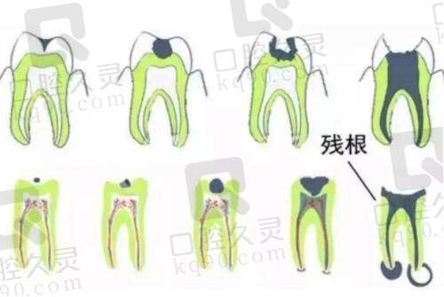深圳瑞芙臣医疗美容的安心保护措施有哪些?