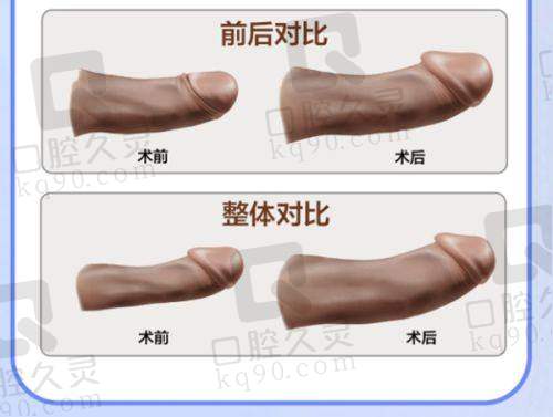 深圳瑞芙臣医疗美容门诊部有哪些热门项目?