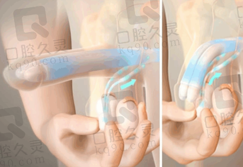 深圳瑞芙臣医疗美容有哪些成功实例?