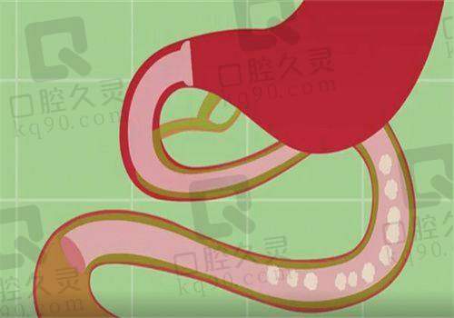 深圳瑞芙臣医疗美容双眼皮整形有哪些项目?