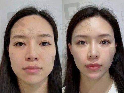 六、术后护理:保护成效