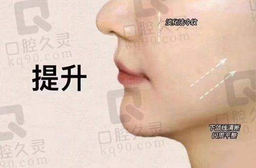 临汾佳美双矢量筋膜提升 1.0 手术9800元起，老牌医院专家操刀抗衰无忧