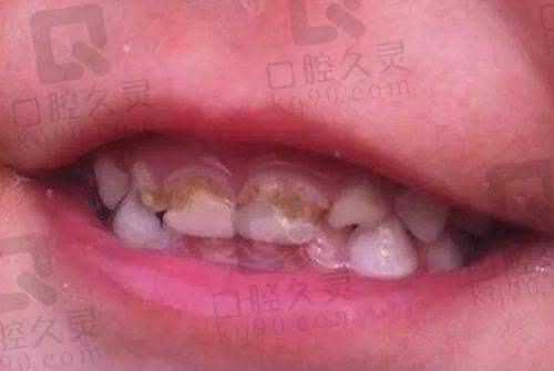 矫正过程中,常德美奥口腔医院的服务如何?