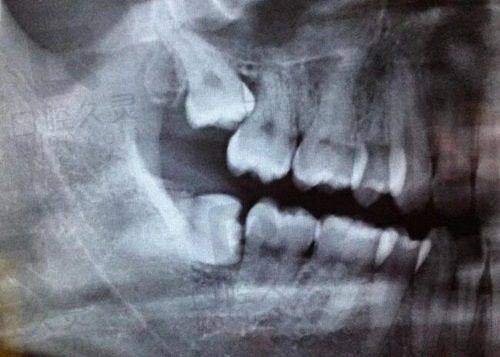 矫正能手:吕王芳主事,让笑容更加灿烂