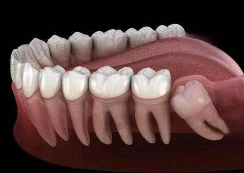 总结:百色唯美口腔——当地居民牙齿治疗的优选