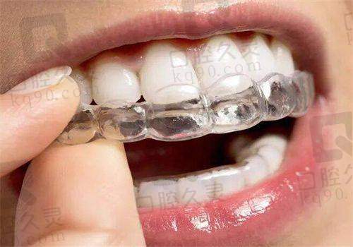 矫正方案是如何制定的?