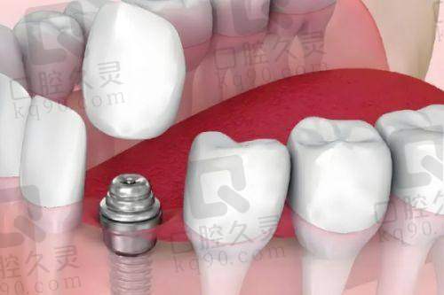 上海鼎植医生马列怎么预约?
