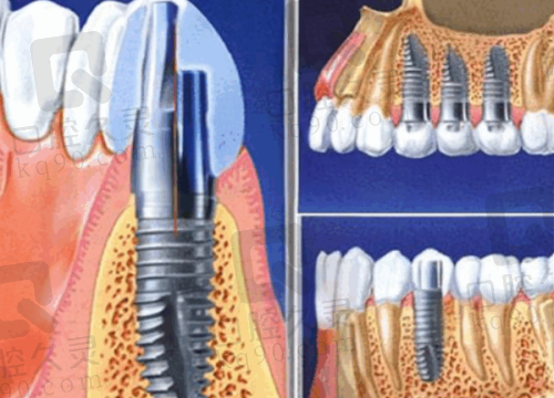宁海桃源口腔门诊部的专精医生团队如何?