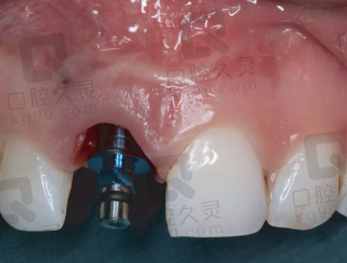 6、咸阳港派心语口腔吕振华医生预约挂号指南