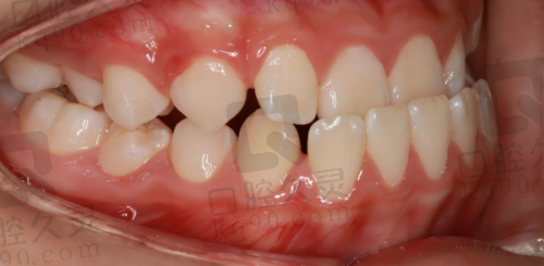 常德美奥口腔医院牙齿矫正的费用是否合理?