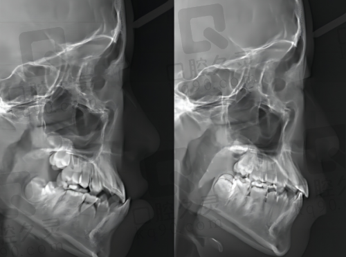 衢州蓝芽口腔的服务质量和环境如何?