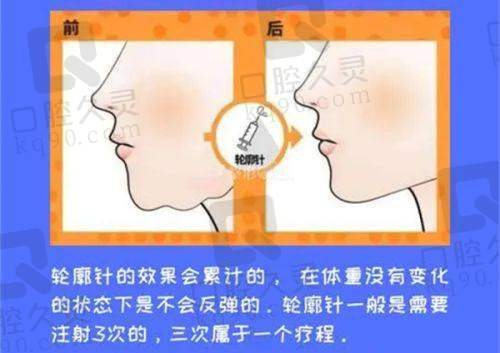 修复期间的变化:惊喜的变化每天都有发生