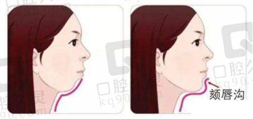 如何选择适合自己的医美项目?