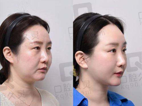 三、戚昌栋技术怎么样?