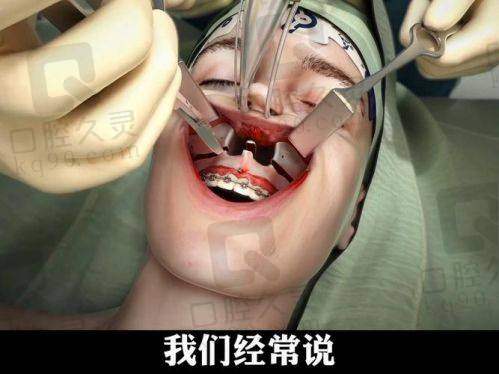 朴兴植正颌案例图片大揭秘,骨性凸嘴、颧骨下颌角术后惊艳蜕变